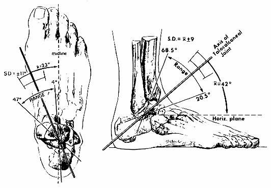 I need help please. Am I Pronation, Neutral and or Supination