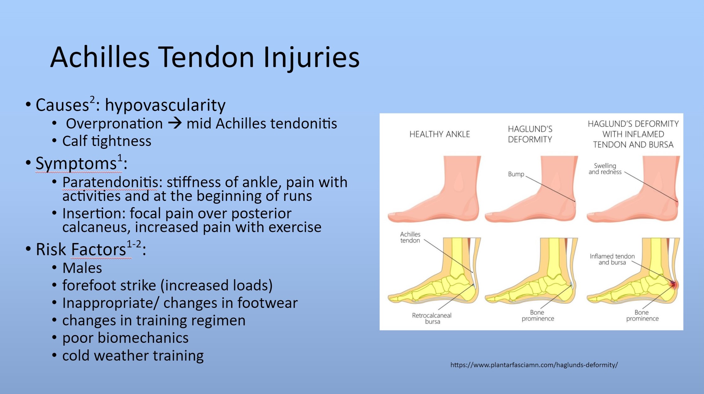 achilles tendon injuries