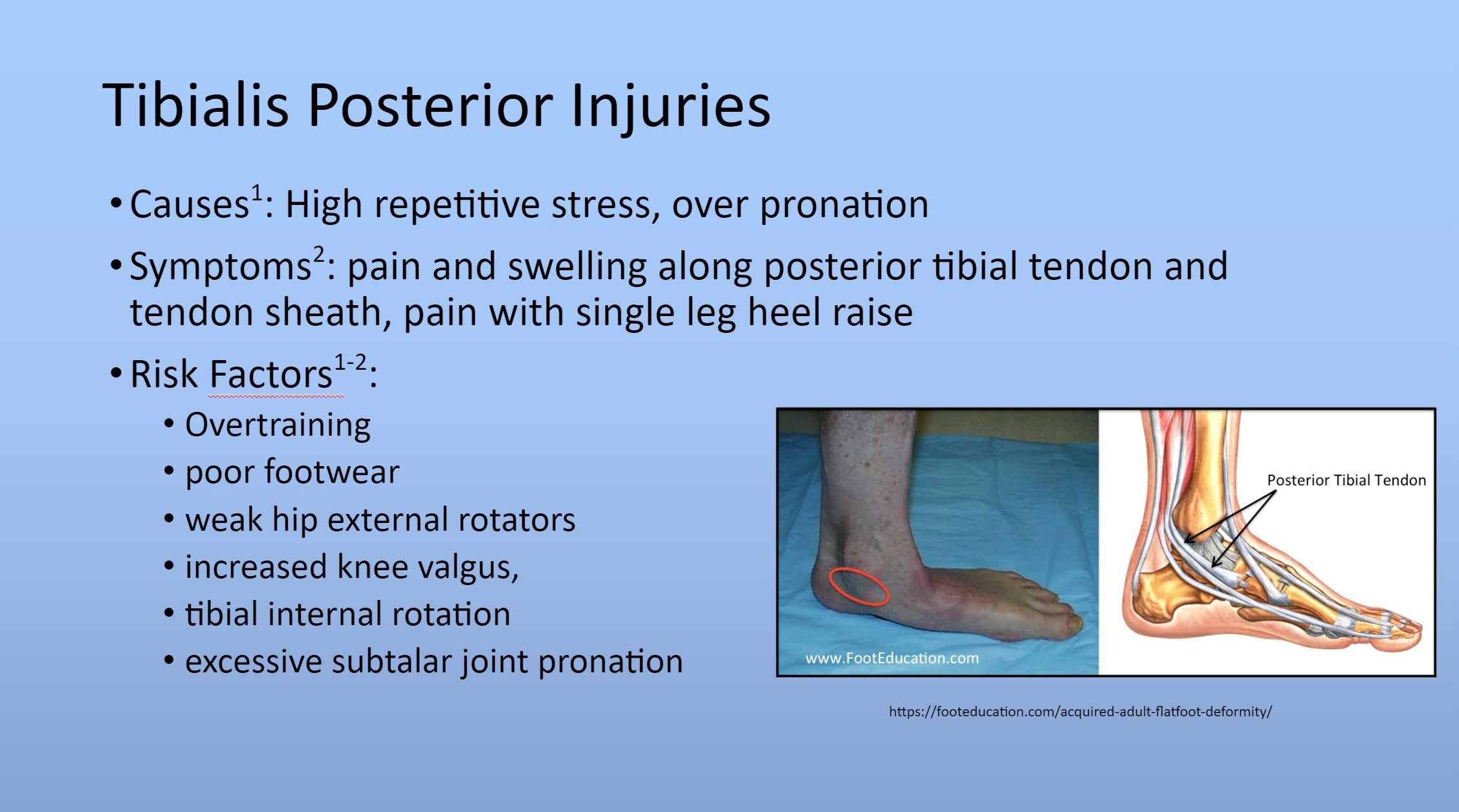 tibialis posterior injuries