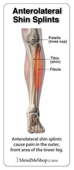 Shin Splints Fleet Feet Hickory