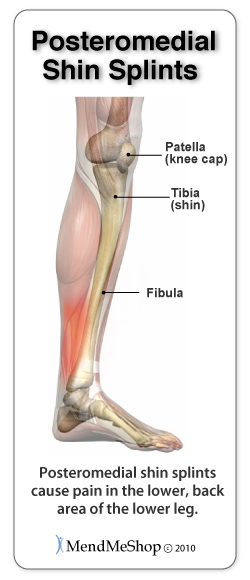 All About Shin Splints - FastMed