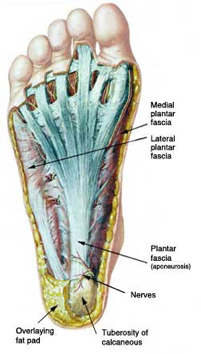 lateral plantar fasciitis pain