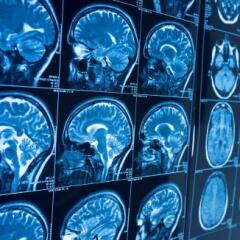 A wall of radiology scans showing a person's brain