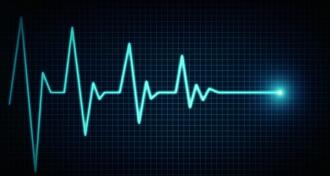 Echocardiogram going from beating to flatline