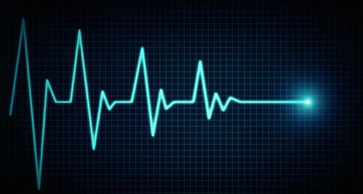 Echocardiogram going from beating to flatline