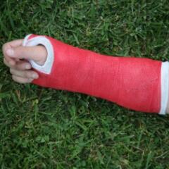 Red wrist arm and hand cast