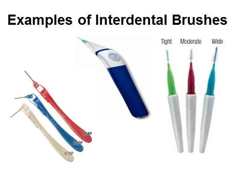 Interdental brushes can be used to clean between the teeth, under bridges, and around implants and braces.